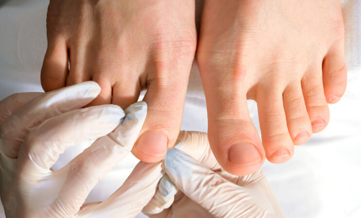 Pedichiura medicala este realizata de specialisti. Tratament eficient pentru unghii incarnate, ingrosate si infectate.